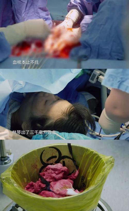 “孕28 周，孩子活了，我死了！” 我曾经以为怀孕很容易，我错了