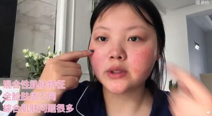 150斤大脸girl也能化成萝莉？被笑太low的美妆博主现在没瘦一样火